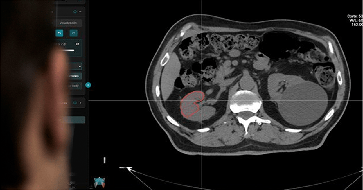 funciones-principales-tecnico-de-radioterapia-dosimetria-oar-train