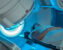 proceso-radioterapico-tecnico-de-radioterapia