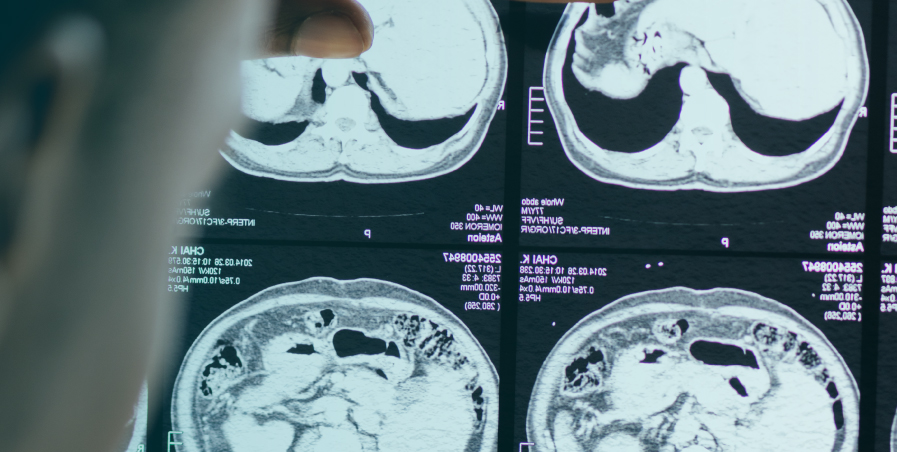 diferencias-entre-radioterapia-dosimetria-imagen-diagnostico-medicina-nuclear-formacion