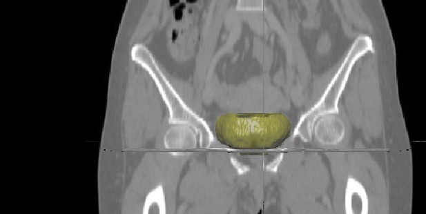 destacada_pelvis_femenina