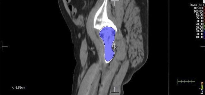 destacada_pelvis_masculina